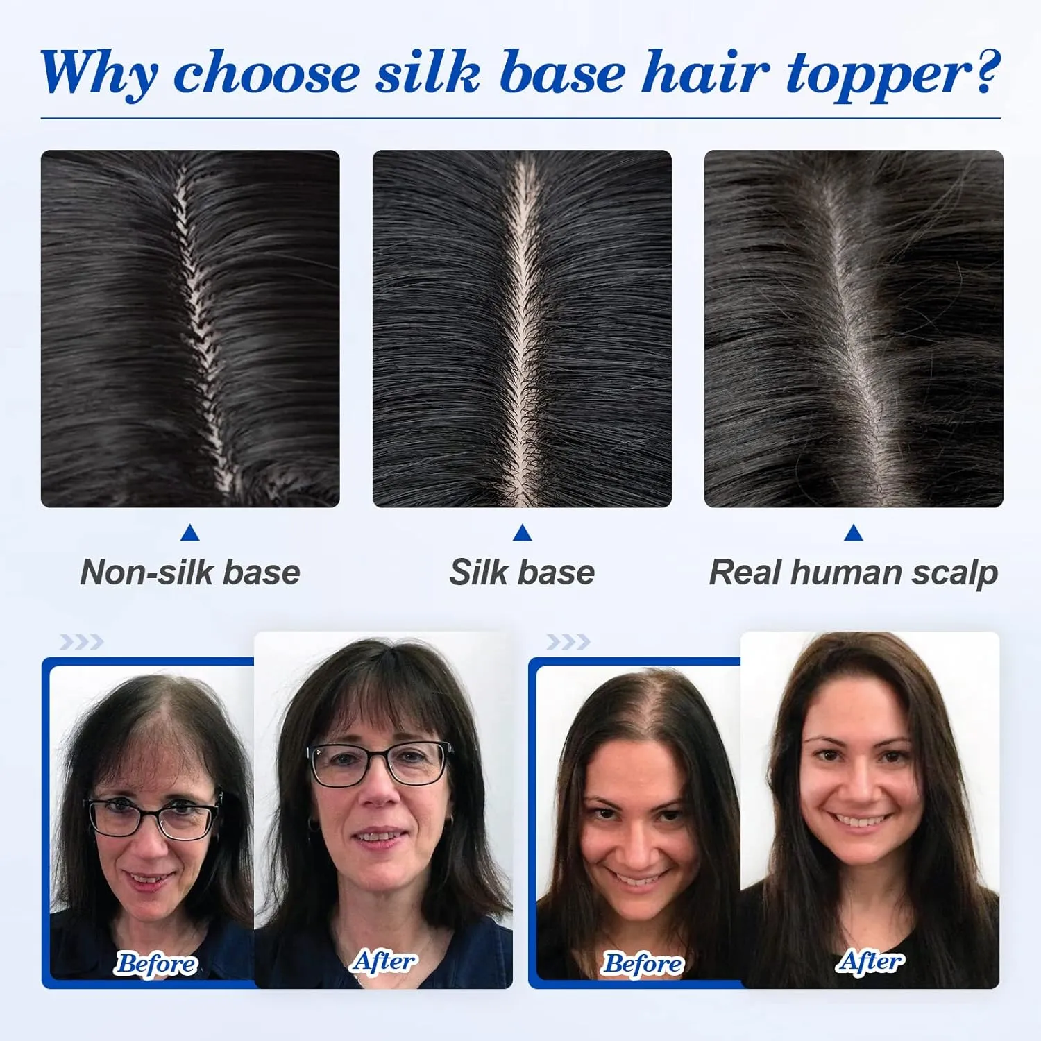 Benehair 14 Inch Hair Toppers for Women Real Human Hair 130% Density 4"x4.7" Hand Made Silk Base 100% Remy Human Hair Wiglets Hairpieces for Thinning Hair -Natural Black #1B