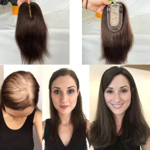 Clip in Hair Toppers - Real Human Hair Pieces, Silk Base Skin Wig - 12 Inch (Brown Color, 3x5inch)