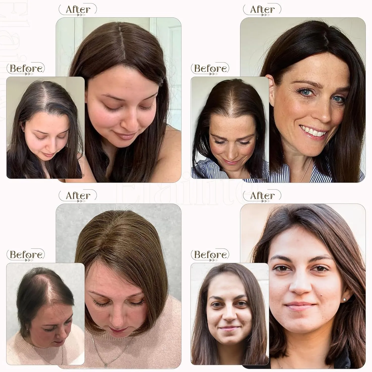 Elailite Hair Toppers for Women - Real Human Hair Free Parting for Thinning Cover, Clip in Pieces for Loss, Gray Fine Hair - 8 Inch #4 Chocolate Brown