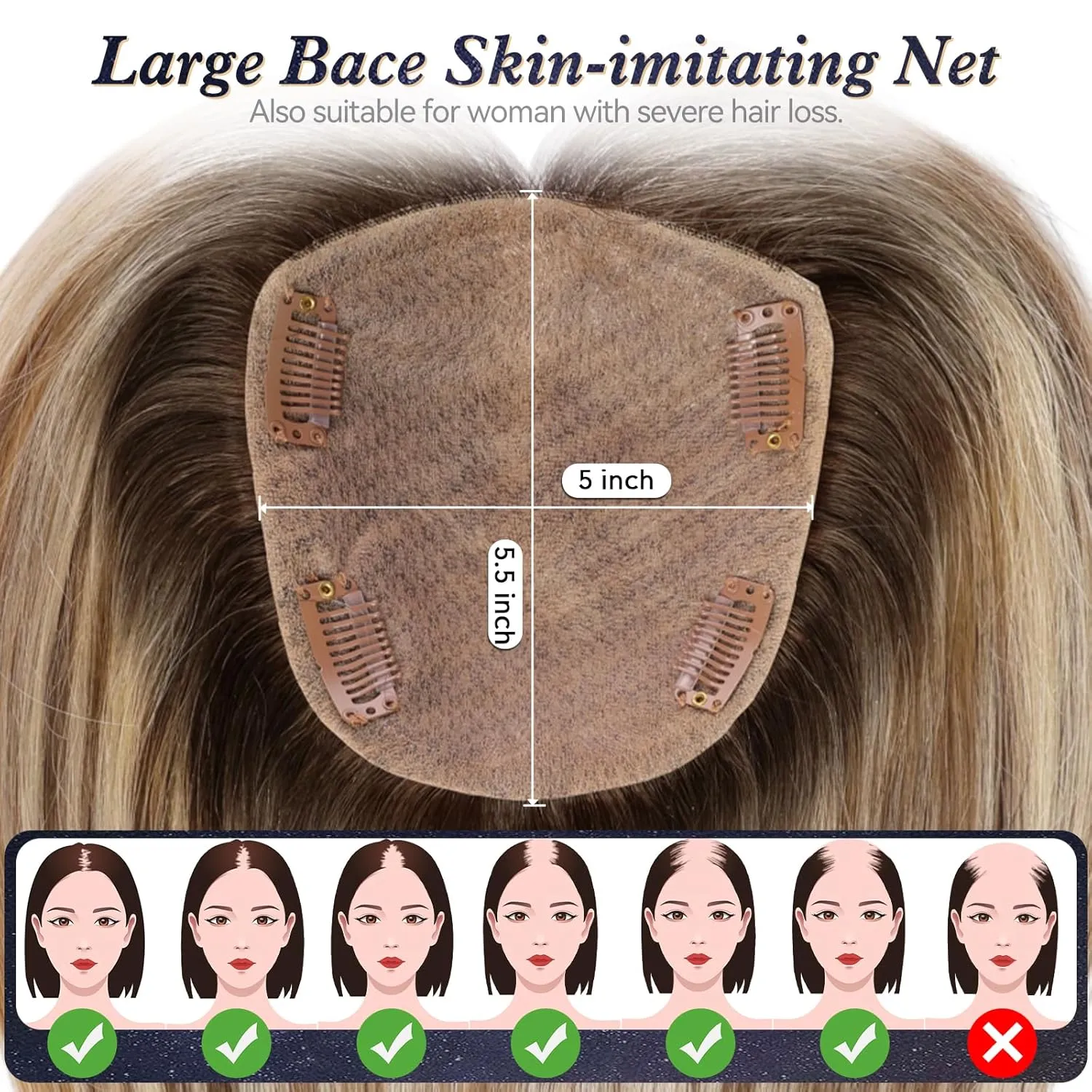starluck Hair Toppers for Women with Bangs, 5"*5.5"Large Coverage Ombre Blonde Mix Brown 100% Real Human Hair,Cover Gray HairRoots,Best Hairtoppers for ThinHair
